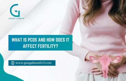 PCOS Fetility Issue